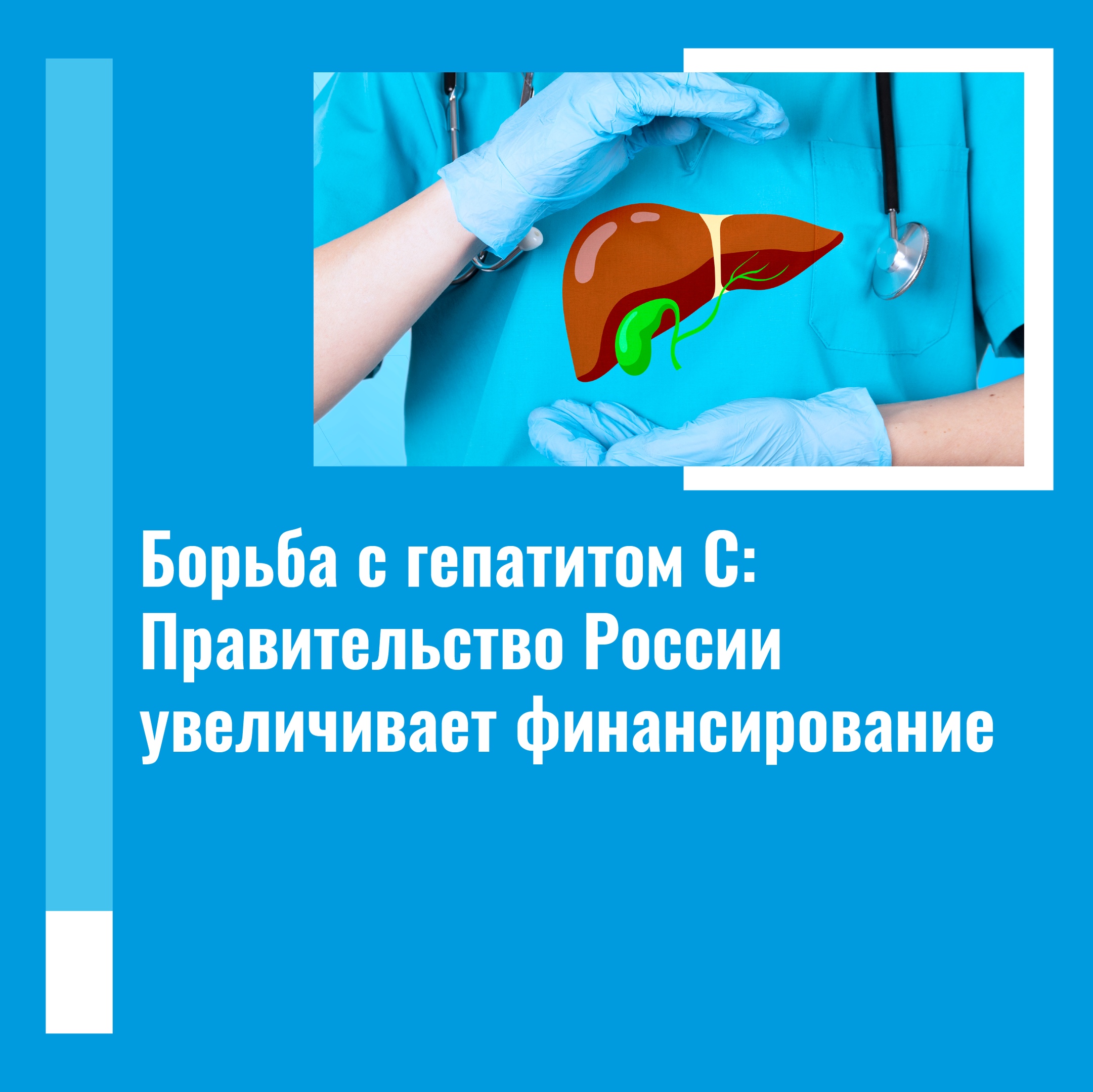 За три года Саратовская область получит 262,5 млн рублей на закупку лекарств для больных хроническим вирусным гепатитом С. Лекарствами будет обеспечено порядка 10 тысяч пациентов.