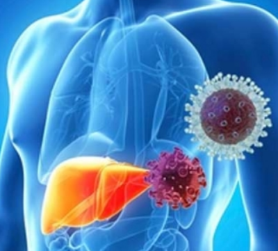 В России проходит неделя профилактики заболеваний печени В России проходит неделя профилактики заболеваний печени