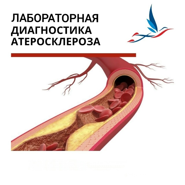 Пройдитте скрининговое исследование крови на атеросклероз в ОККД