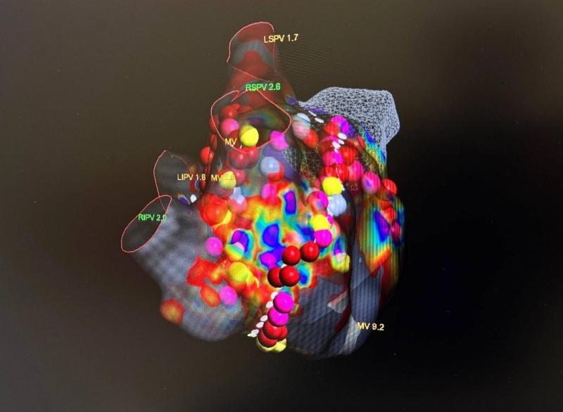 Современный навигационный комплекс помогает хирургам ОККД успешно лечить сложные аритмии